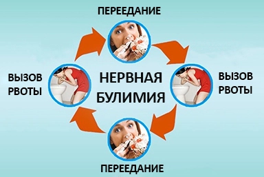 Лечение булимии в Нововеличковской
